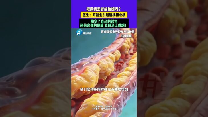 5月4日（發布）河南鄭州，糖尿病患者能抽煙嗎？醫生：可能會引起腦梗和心梗，掏空了自己的錢包，還傷害你的健康 立刻馬上戒煙！（編輯：心然，阿月）