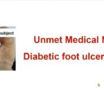 糖尿病患者足部出現潰瘍(DFU_Diabetic Foot Ulcer)速必一乳膏