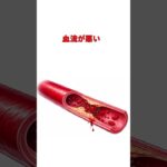 糖尿病　足のしびれは崩壊の合図　元看護師４０年　#糖尿病 #糖尿病性神経障害 #足のしびれ #血糖値 #元看護師 #健康習慣 #生活習慣病 #予防医学 #フットケア #YouTubeショート