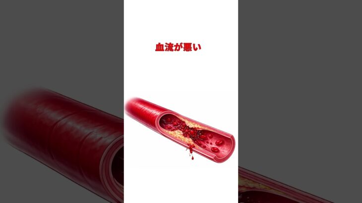 糖尿病　足のしびれは崩壊の合図　元看護師４０年　#糖尿病 #糖尿病性神経障害 #足のしびれ #血糖値 #元看護師 #健康習慣 #生活習慣病 #予防医学 #フットケア #YouTubeショート