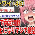 【悲報】糖尿病が悪化   両足切断宣告でマジで絶望してる。