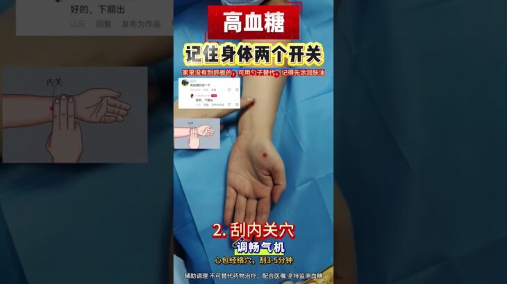 两个开关控制糖尿病#控糖 #糖尿病  #高血糖 #医学科普 #中医