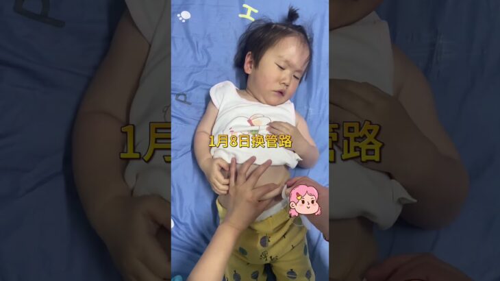 今天给崽换个管路#糖尿病 #控糖饮食 #抗糖生活 #糖友 #控糖