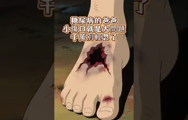 糖尿病的爸爸，腳上的小傷口就是大問題，千萬別輕忽了！