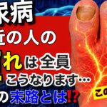 【衝撃】糖尿病間近の人の「痺れ」は全員こうなります！ちょっとした変化でも見落とすと足切断です。
