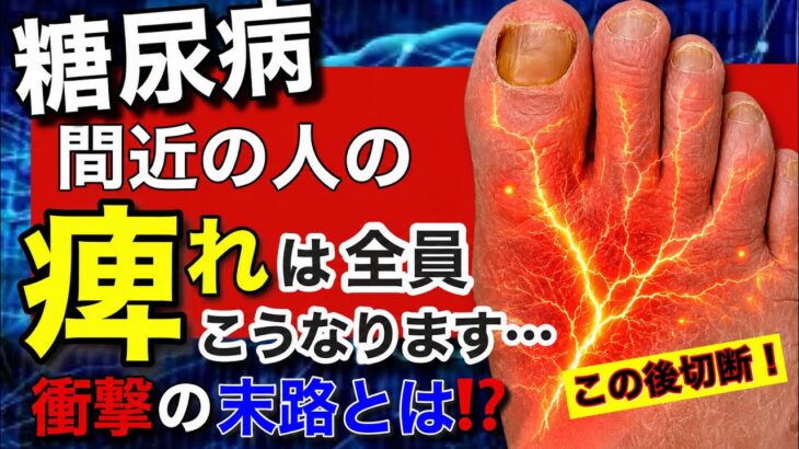 【衝撃】糖尿病間近の人の「痺れ」は全員こうなります！ちょっとした変化でも見落とすと足切断です。