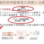 わかりやすい糖尿病性神経障害