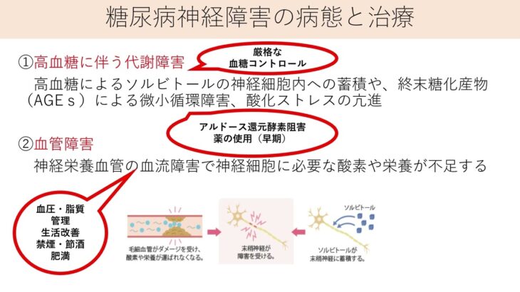 わかりやすい糖尿病性神経障害