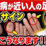 糖尿病と整形外科疾患の深すぎる関係！手や足の違和感は要注意のサイン