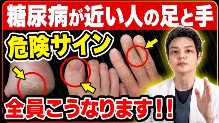 糖尿病と整形外科疾患の深すぎる関係！手や足の違和感は要注意のサイン