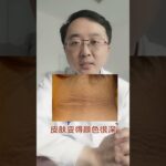 这四个指标异常，你离糖尿病不远了#硬核健康科普行动 #糖尿病