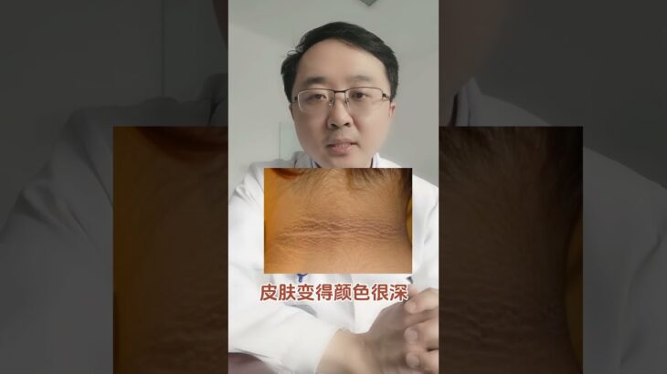 这四个指标异常，你离糖尿病不远了#硬核健康科普行动 #糖尿病