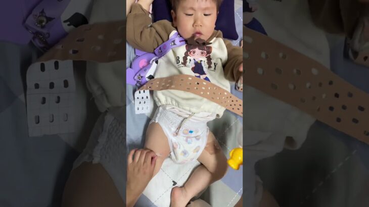 这几次换管路拔动态恩仔开始不配合了#控糖饮食 #抗糖生活 #糖尿病 #糖友 #控糖