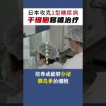 终身打胰岛素的时代，会结束吗？这一次，是干细胞。日本完成全球首例1型糖尿病自体脂肪干细胞移植治疗，首位患者已顺利出院。再生医疗，正在改写未来。#一型糖尿病 #干细胞 #糖尿病
