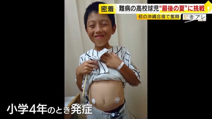 小学4年で発症…難病「1型糖尿病」を患う高校球児　“最後の夏”に挑戦　「正直、無理かもしれないと思ったことはあったけど…」 ／ (2026/05/27  OA)