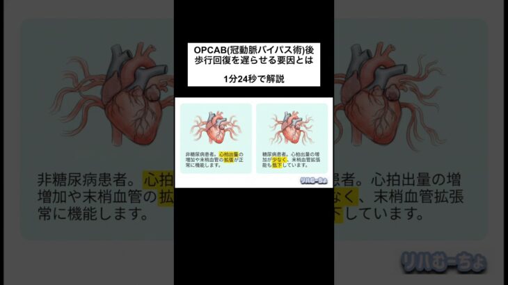 OPCAB(冠動脈バイパス術)後は糖尿病があると回復が遅延する？