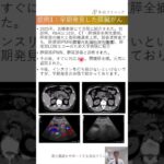 画像からの早期発見：膵臓がん #糖尿病専門医 #多田クリニック #腎臓病 #倉敷 #糖尿病 #生活習慣病 #hba1c #マンジャロ
