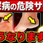 【放置危険】進行する前に知って欲しい『隠れ糖尿病』の初期症状･危険サイン７選【セルフチェック法を医師解説】