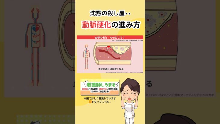 【糖尿病】血管を守るために知ってほしい。沈黙の殺し屋「動脈硬化」の進み方