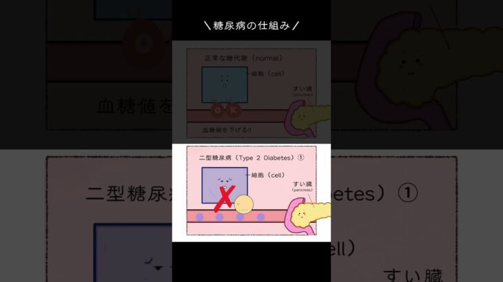 ＼糖尿病のメカニズム／ #解剖生理学