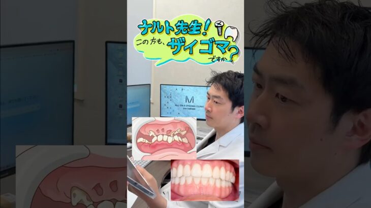 持病が高血圧と糖尿病…この方もザイゴマですか？㊲