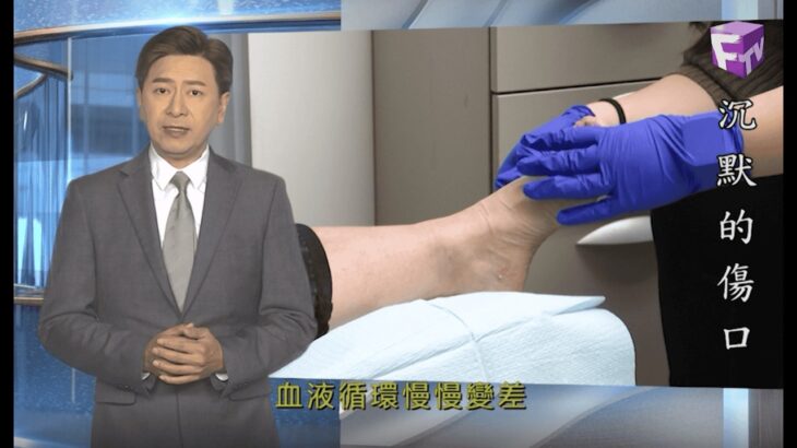 【時代雜誌】2026年7月8日 – 沉默的傷口 (糖尿病足潰瘍威脅健康 足部護理成預防截肢重要一環)