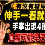 有沒有糖尿病？伸手一看就知道！手掌出現這4種變化，其實是內臟在求救！#糖尿病前期 #血糖管理 #中醫養生 #手掌警訊 #50歲後養生
