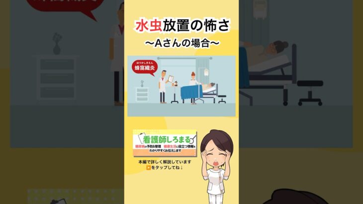 【糖尿病】水虫放置で起こった悲劇〜Aさんの場合〜