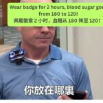 糖尿病 I 型 Diabetes I