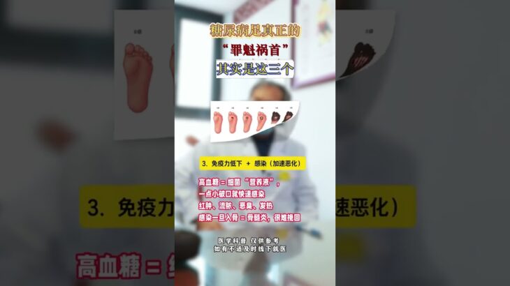 糖尿病足真正的「罪魁禍首」其實是這三個！ #糖尿病足 #糖尿病 #高血糖 #健康dou起來