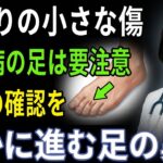 静かに進む足の異変今すぐ確認したい糖尿病のサイン