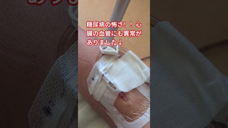 糖尿病で、心臓の動脈に、異常発見手術決定の巻　#糖尿病  #合併症 #手術 #怖い