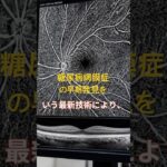 糖尿病と診断されたら眼科受診を。#糖尿病網膜症