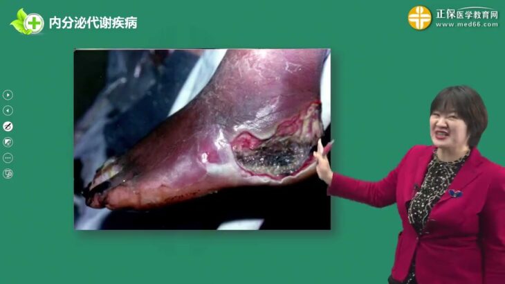 内科学 王逸 0603第03讲糖尿病一