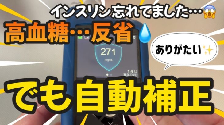【1型糖尿病】インスリン打ち忘れ！気付いた時には高血糖でした… MiniMedミニメド780G