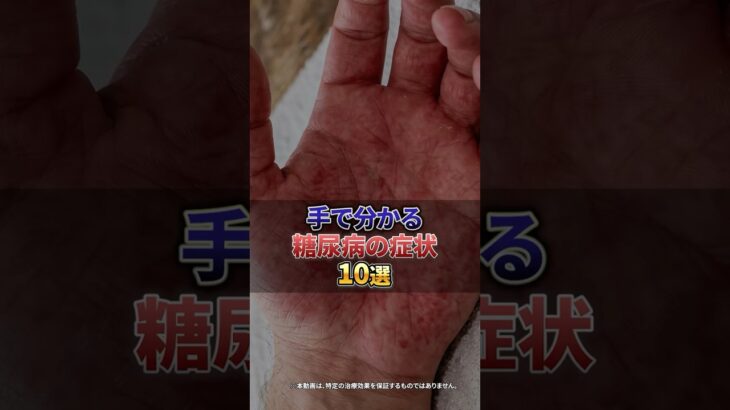 手で分かる糖尿病の症状10選