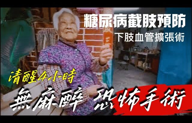 無麻醉4小時恐怖手術！糖尿病截肢前搶救「下肢血管擴張術」