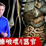 糖尿病6.高血糖破壞4器官,腎臟,眼睛,血管疾病,糖尿病原因?低碳水,控制胰島素很重要！柏格醫生Dr Berg