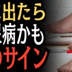 【要注意】足に現れる9つのサイン…糖尿病の可能性を見逃さないで！