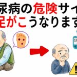【警告】絶対放置しないで！足に現れる「糖尿病の危険サイン」9選