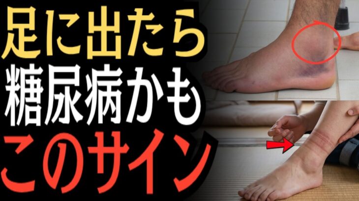 【要注意】足に現れる9つのサイン…糖尿病の可能性を見逃さないで！