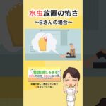 【糖尿病】水虫放置で起こった悲劇〜Bさんの場合〜