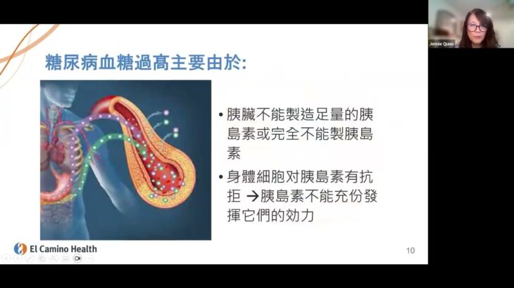 御糖有術-預防糖尿病課程 說明會｜註冊營養師關潘靜儀主講 Diabetes Prevention Series Info Session | El Camino Health