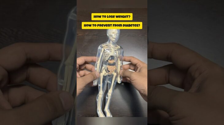 How to prevent from Diabetes! Diabetes diet plan! Type 2 Diabetes! #diabetes #type2diabetes
