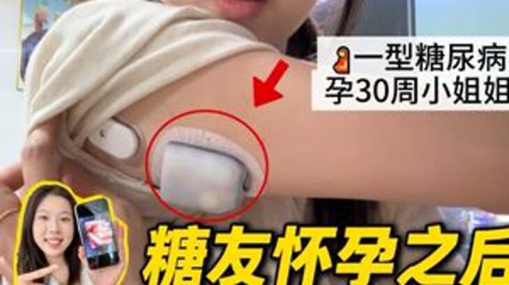 控糖干货分享！带泵还是打针？糖尿病一型糖尿病孕期控糖控糖经验