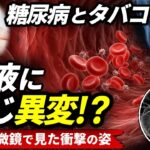 糖尿病とタバコに共通する「傷が治りにくい理由」とは【電子顕微鏡】