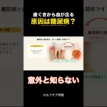 【必見】糖尿病と歯周病の関係