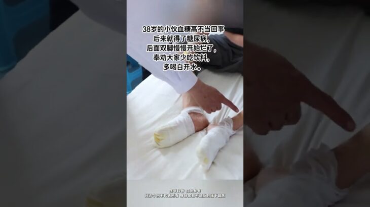 #糖尿病足 #糖尿病 #創作者大會 #高血糖
