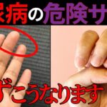 【医師監修】絶対に見逃してはいけない「糖尿病の手からの危険サイン」症状から予防法まで徹底的に解説します