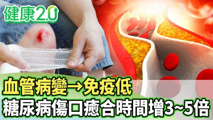 血管病變→免疫低 糖尿病傷口癒合時間增3~5倍！【健康2.0分段】@tvbshealth20  EP3226-2 20260830 #陳欣湄#韋汝#祝年豐#吳明珠#趙函穎#陳少偉